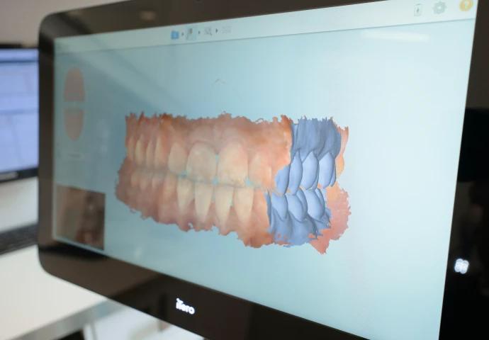 Empreinte optique 3D au Cabinet d'Orthodontie du Docteur Bendahan à Paris 17