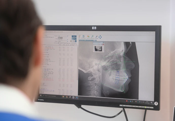 Radiographie numérique au Cabinet d'Orthodontie du Docteur Bendahan à Paris 17