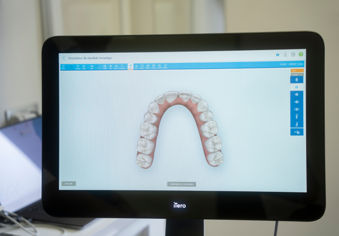 Logiciel de simulation orthodontique au Cabinet du Docteur Bendahan à Paris 17